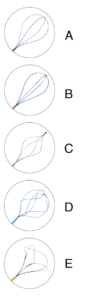 Specification of Stone Retrieval Basket - 2