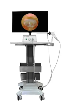 Video Endoscopy