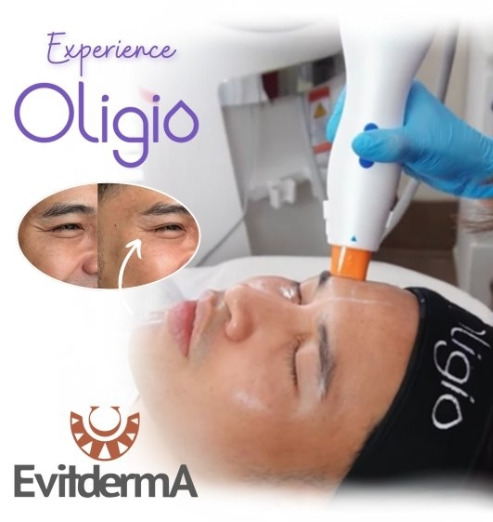 Anti-Aging Procedure Oligio