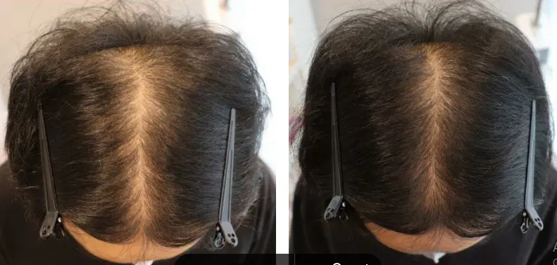 apakah smoothing merusak rambut