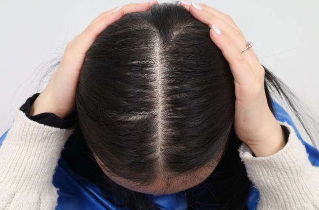 Perawatan Rambut Rontok Keenam?