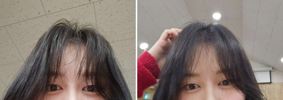 Perawatan Rambut Rontok Keenam