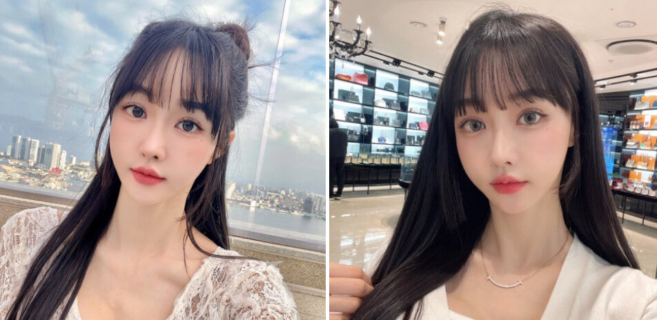 Kerontokan Rambut pada Wanita