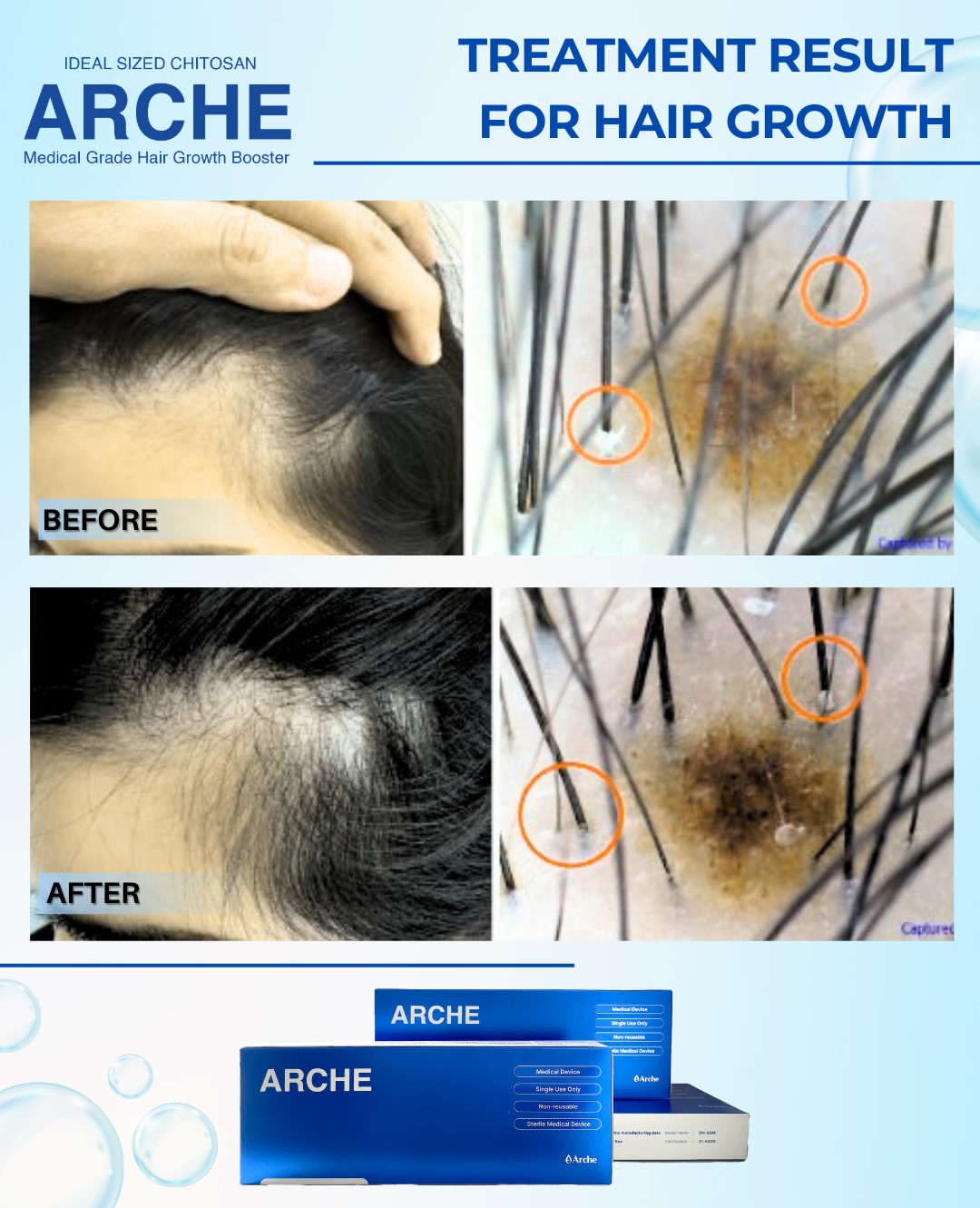 perawatan rambut rontok dan ketombe