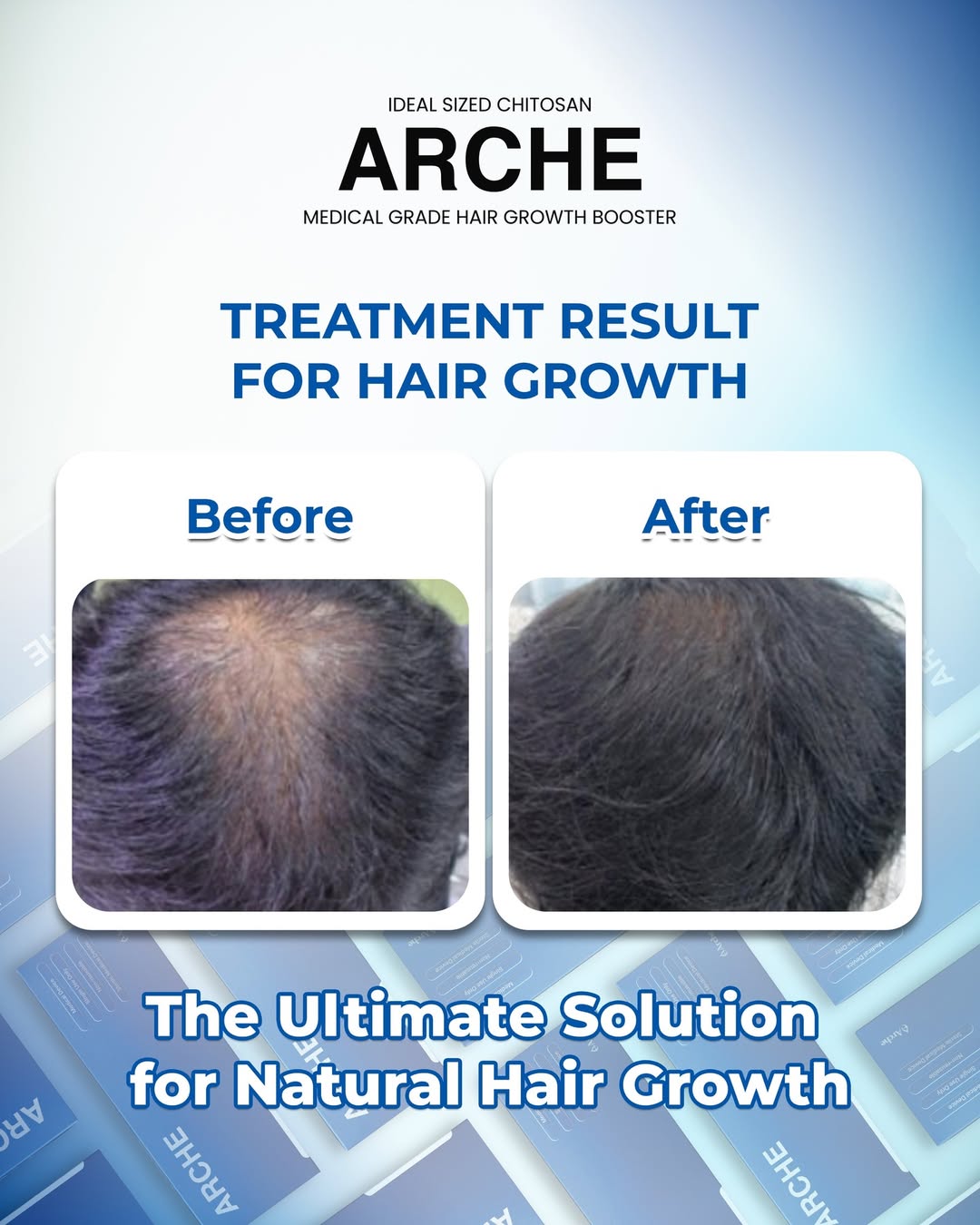 Perawatan rambut arche
