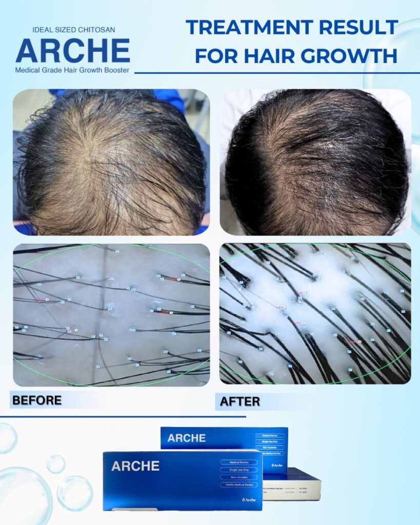 cara membuat rambut tebal