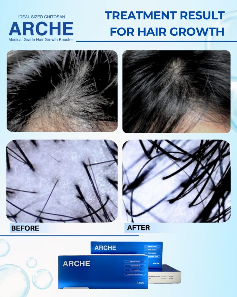 apakah rambut tipis bisa tebal