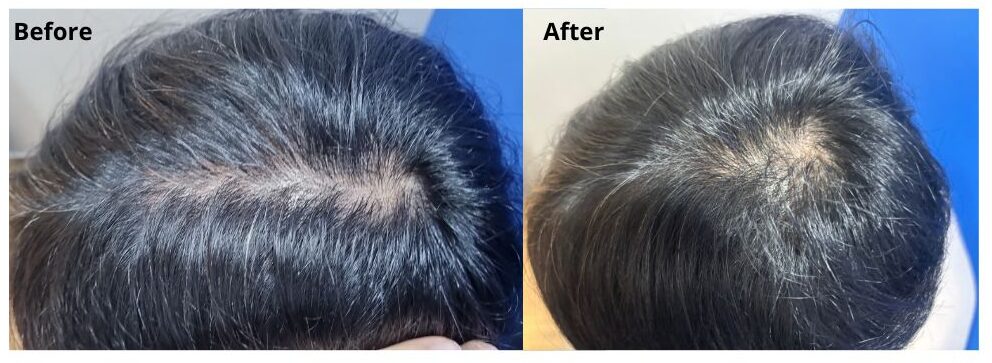perawatan rambut arche