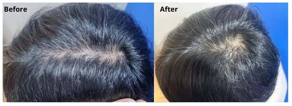 perawatan rambut arche