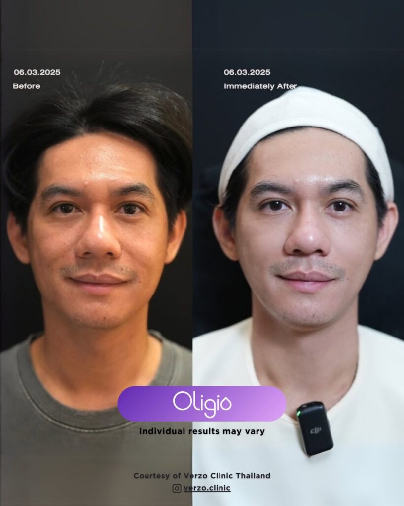 Menyamarkan Garis Halus