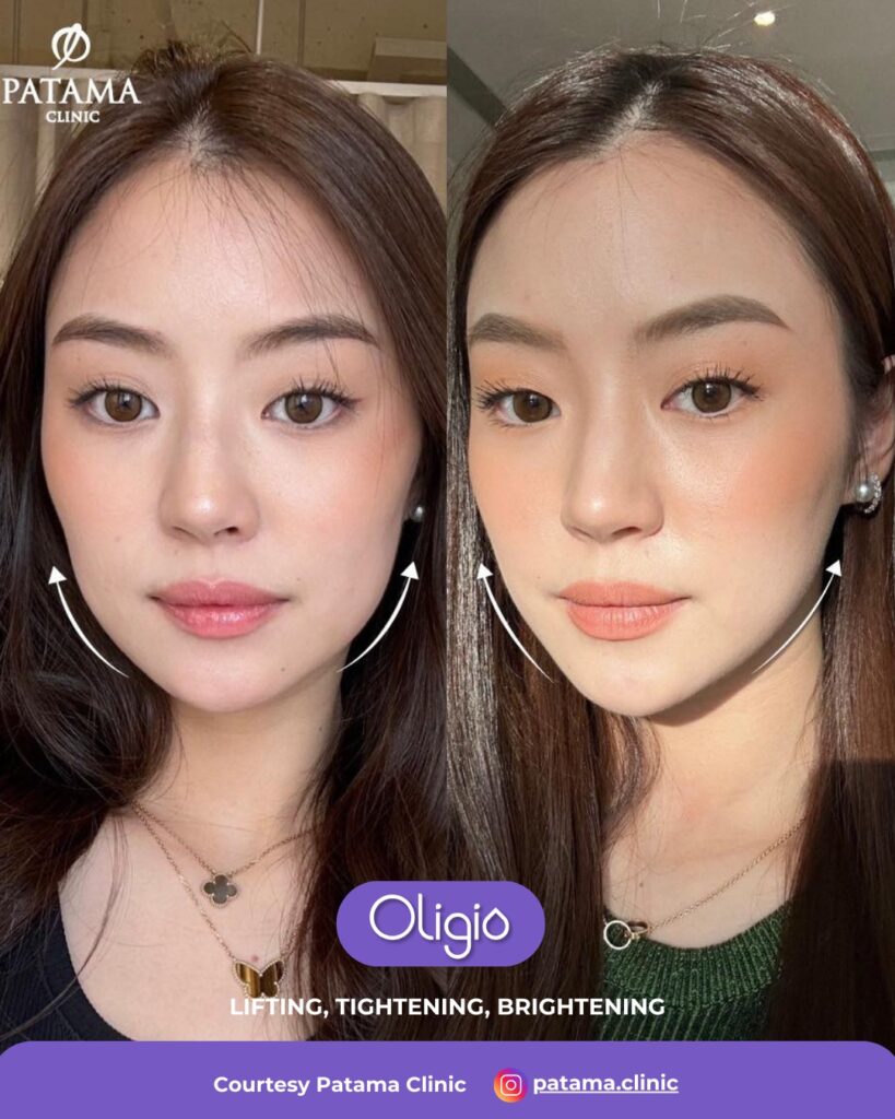 resep awet muda dan cantik secara alami