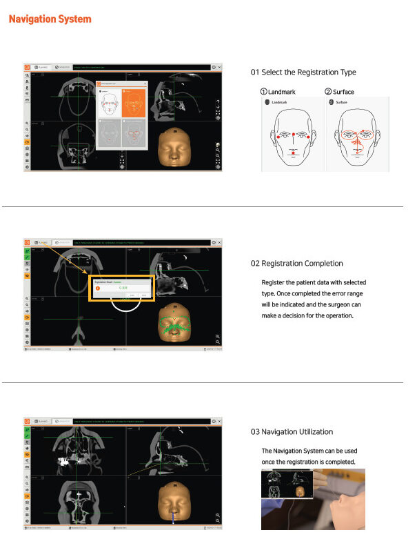 NAVIOL ENT Surgery Navigation System