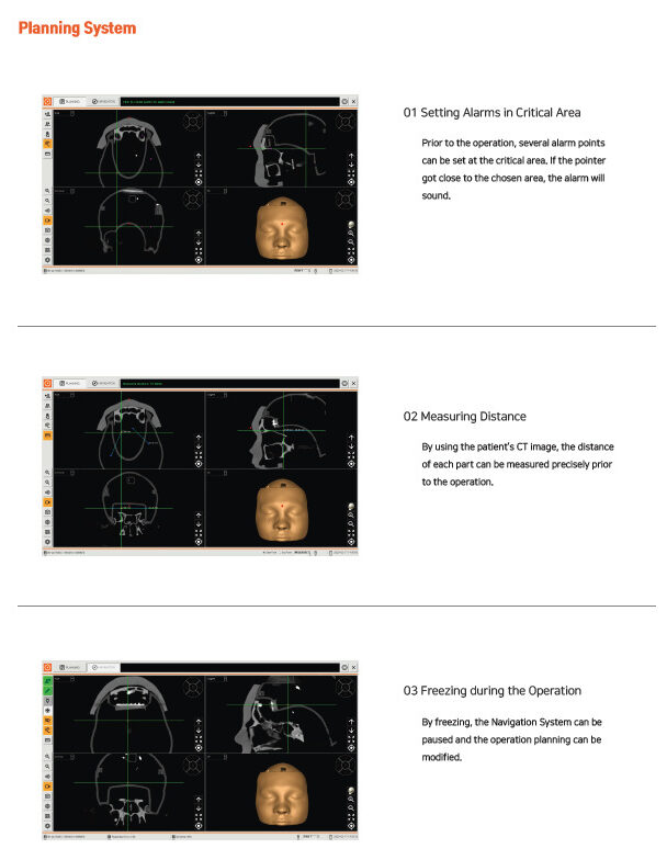 NAVIOL ENT Surgery Navigation System