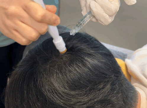 perawatan rambut arche