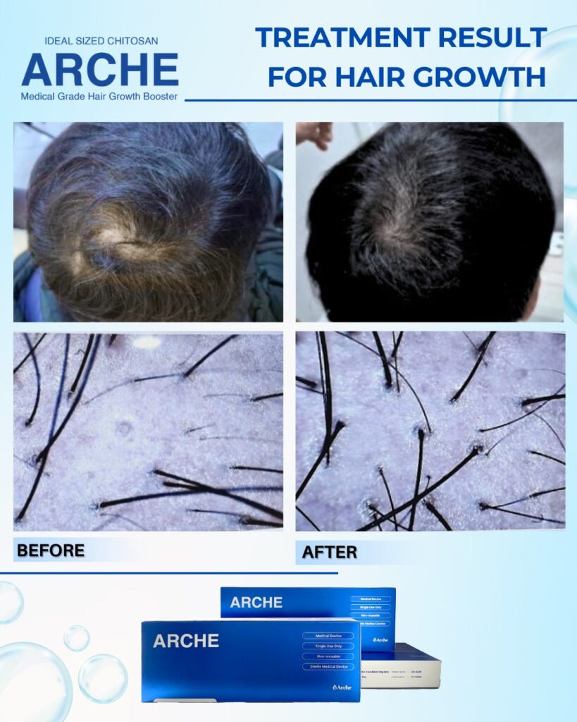 bagaimana mengatasi rambut rontok