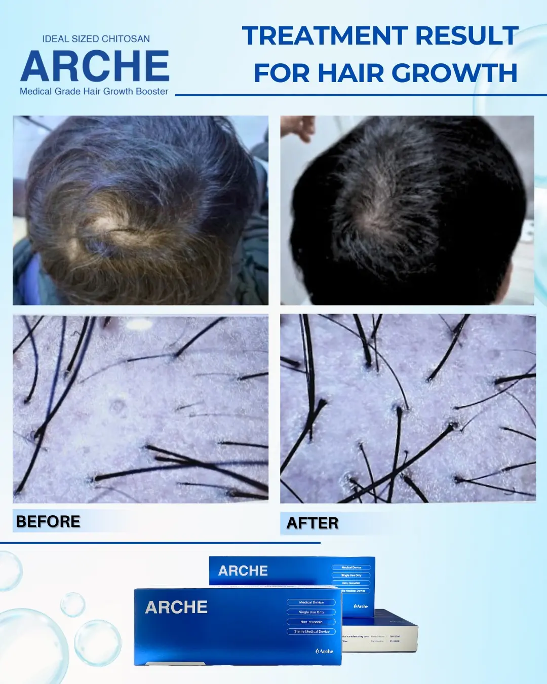 pitak rambut