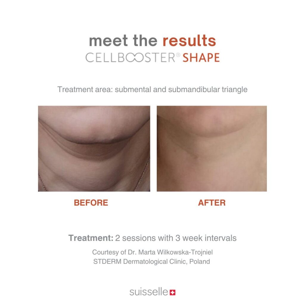 Rekomendasi Perawatan Wajah Pria