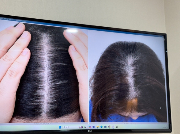 Program Manajemen Rambut Rontok Arche
