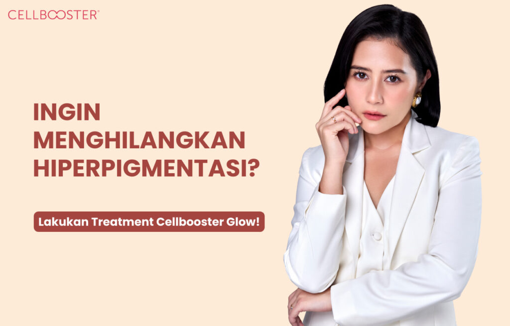 Cara Menghilangkan Hiperpigmentasi