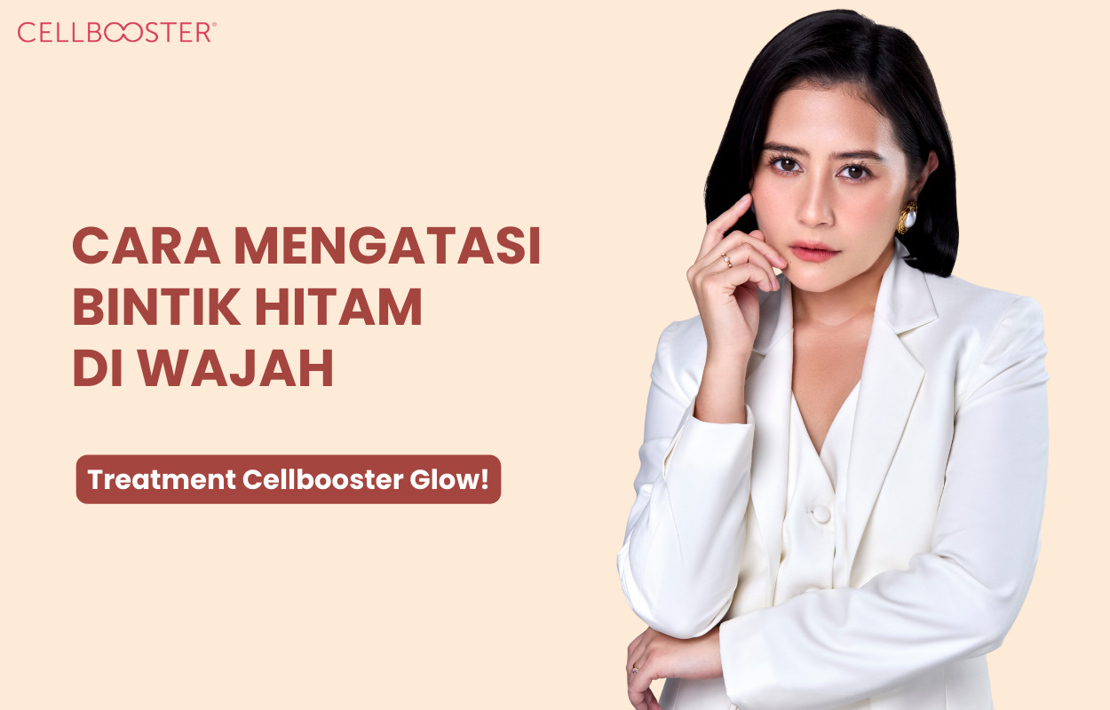 Mengatasi Bintik Hitam