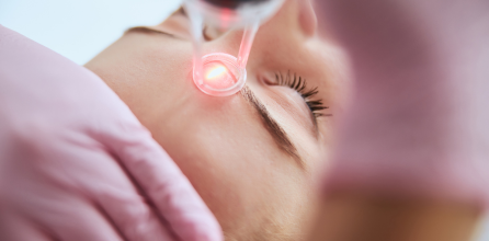 Laser Treatment