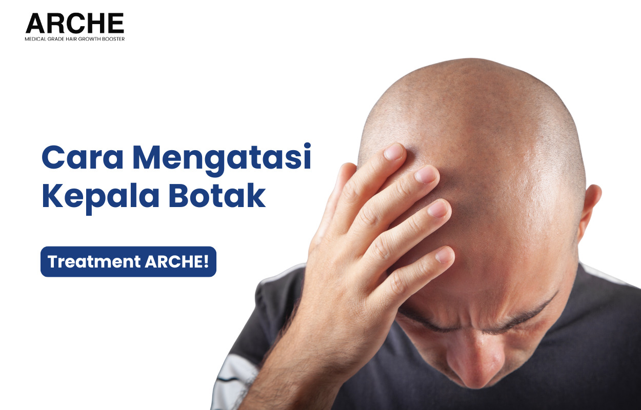 Penyebab Kepala Botak