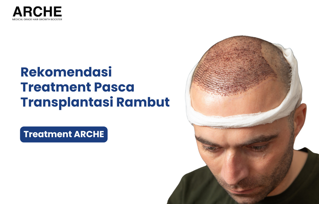 Transplantasi Rambut