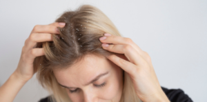Cara mengatasi kulit kepala kering