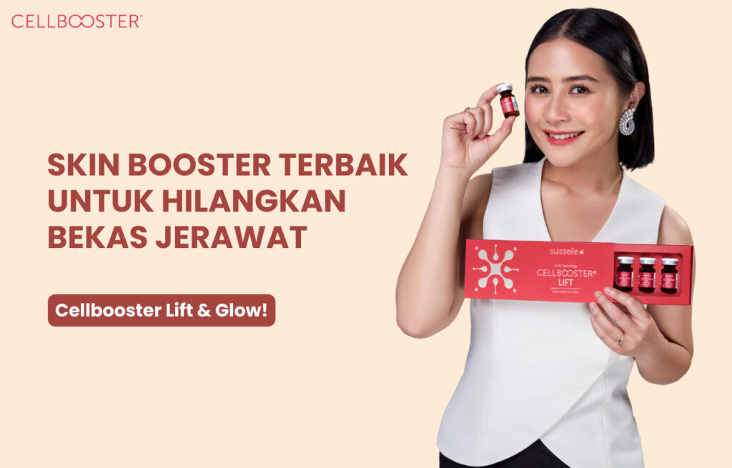 Menghilangkan Bekas Jerawat