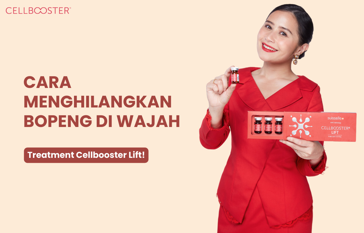 8 Cara Menghilangkan Bopeng di Wajah