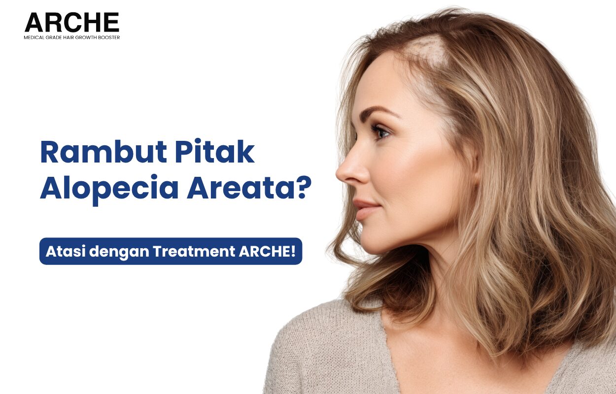 Alopecia Areata!