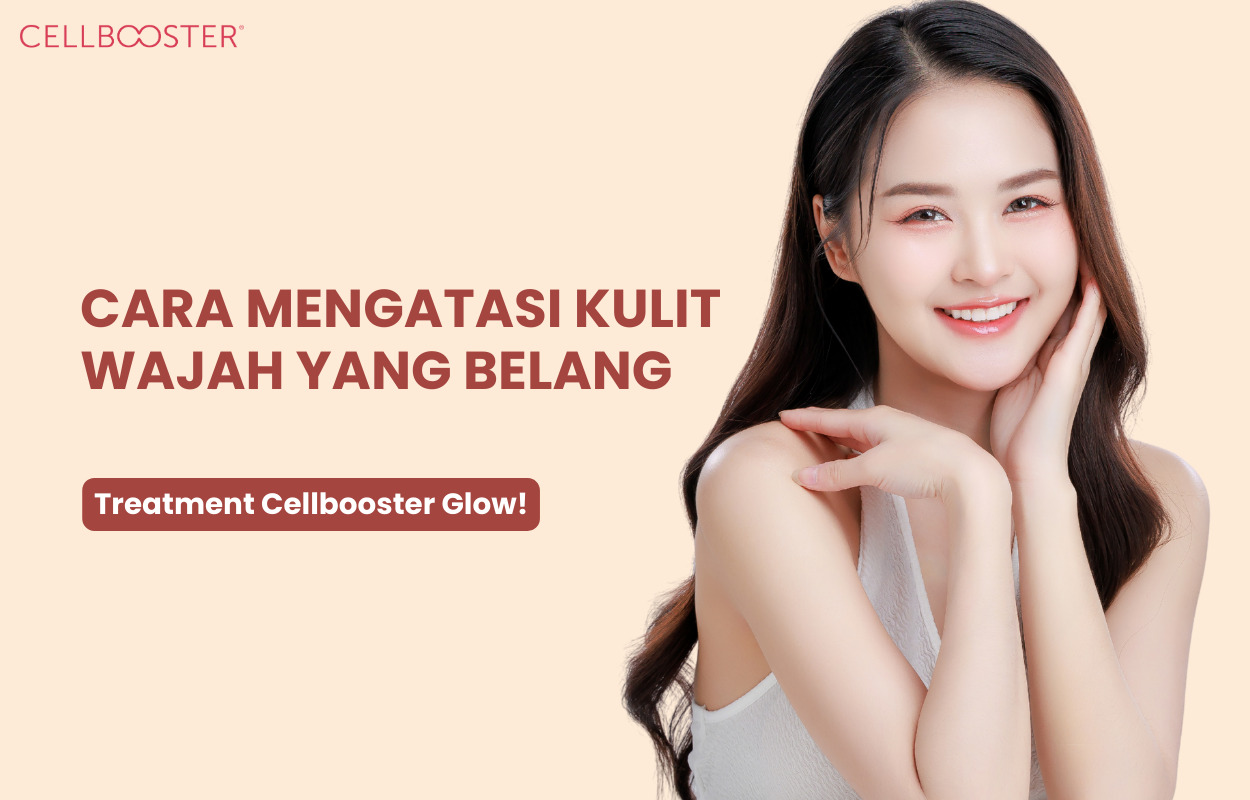 Mengatasi Kulit Belang