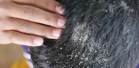 Relaksasi dan perawatan kulit kepala untuk mengurangi stres