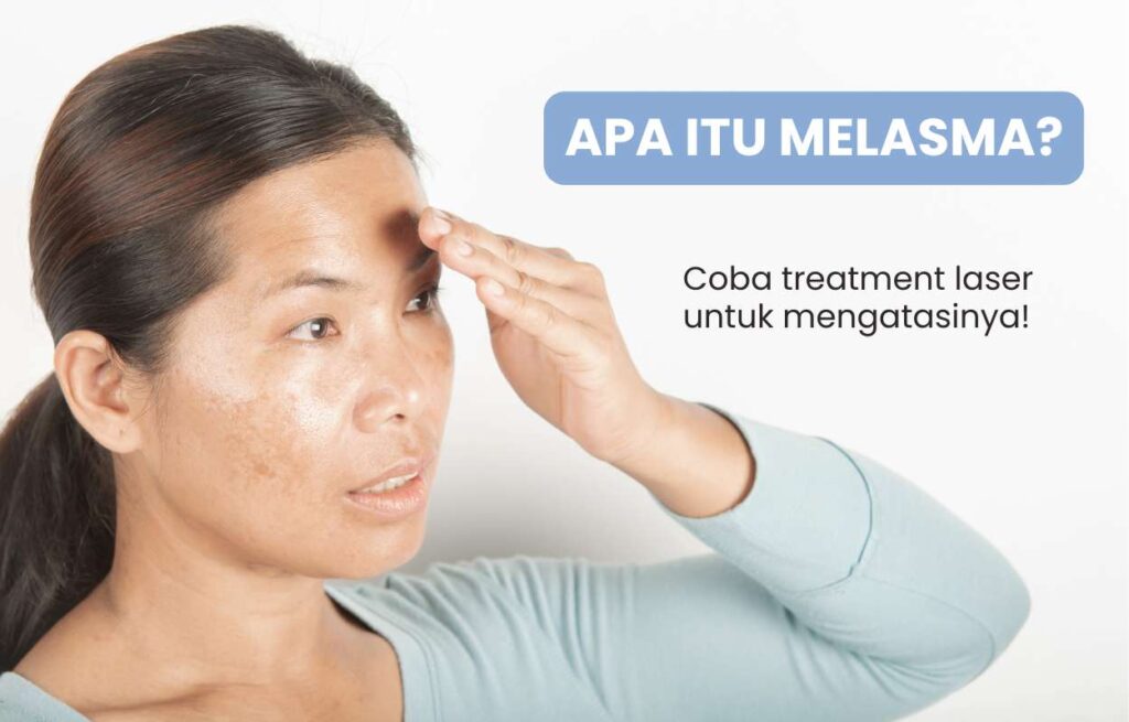 Apa itu melasma