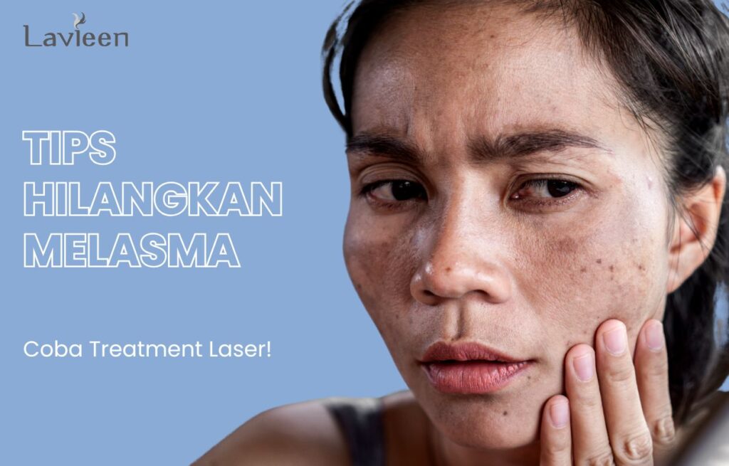 Cara menghilangkan melasma di wajah dengan cepat