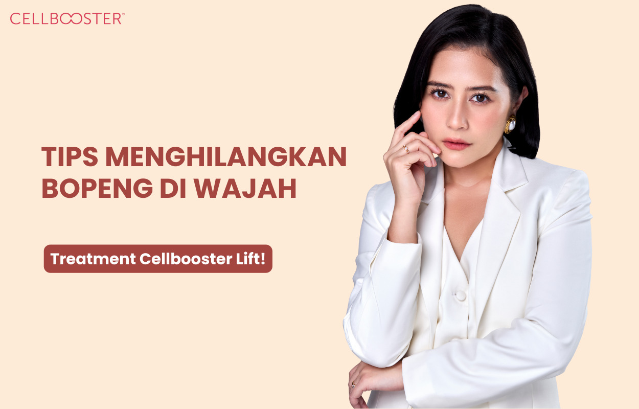 Tips Menghilangkan Bopeng