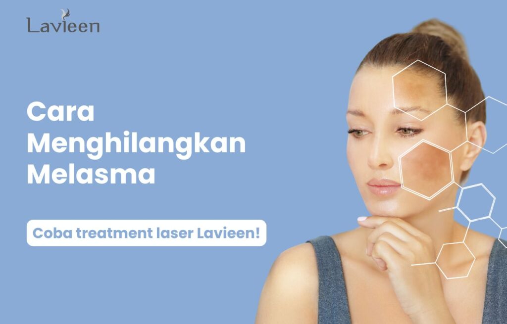 Cara menghilangkan melasma di wajah dengan cepat