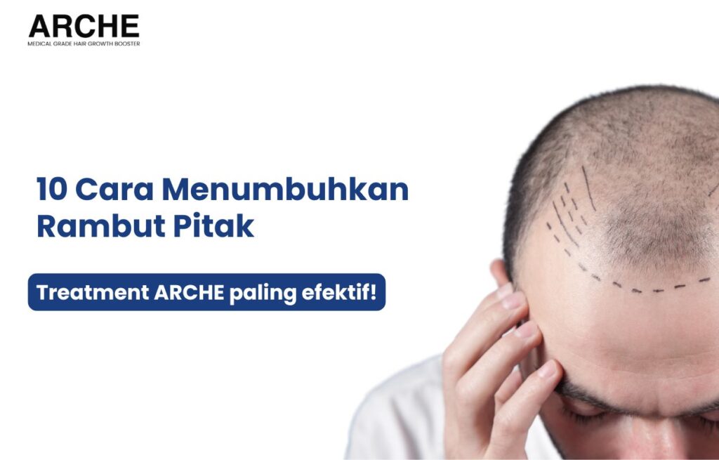 cara menumbuhkan rambut yang pitak