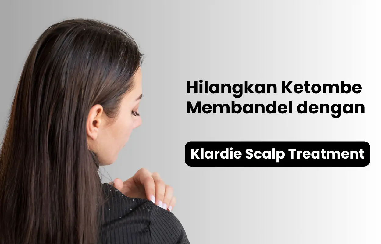 cara mengatasi ketombe basah