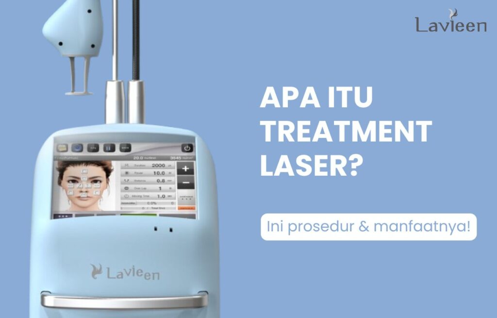 Treatment laser