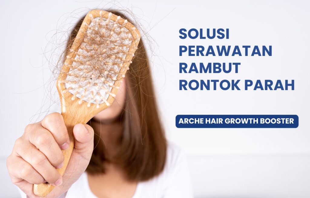 Perawatan rambut rontok parah