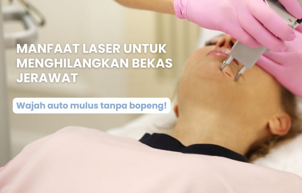 Laser untuk menghilangkan bekas jerawat