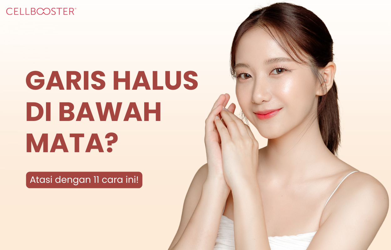 Garis Halus di Bawah Mata