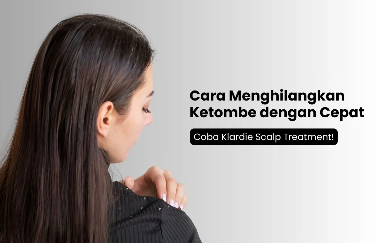 cara menghilangkan ketombe dengan bahan alami