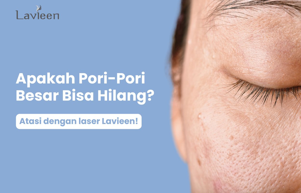 apakah pori-pori besar bisa hilang