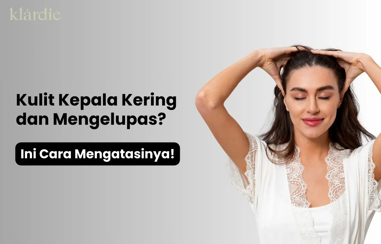 kulit kepala kering mengelupas