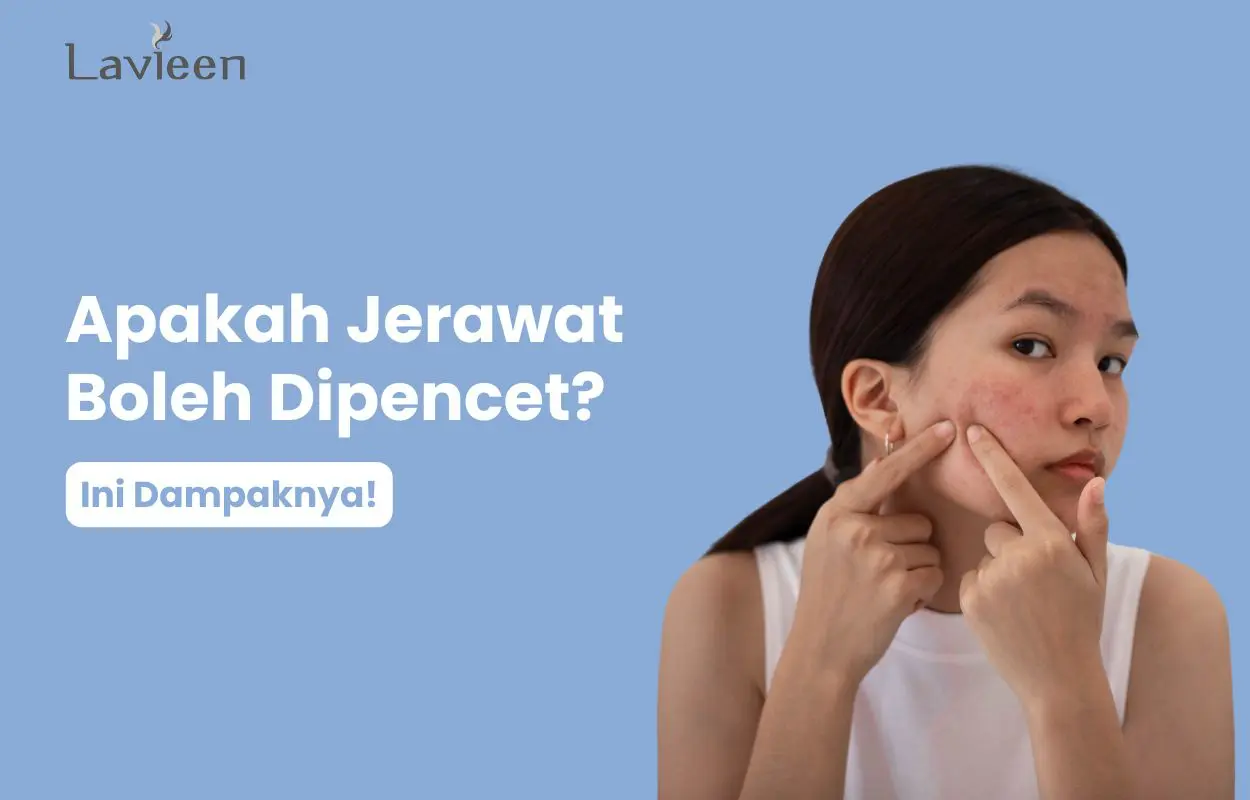 apakah jerawat boleh dipencet