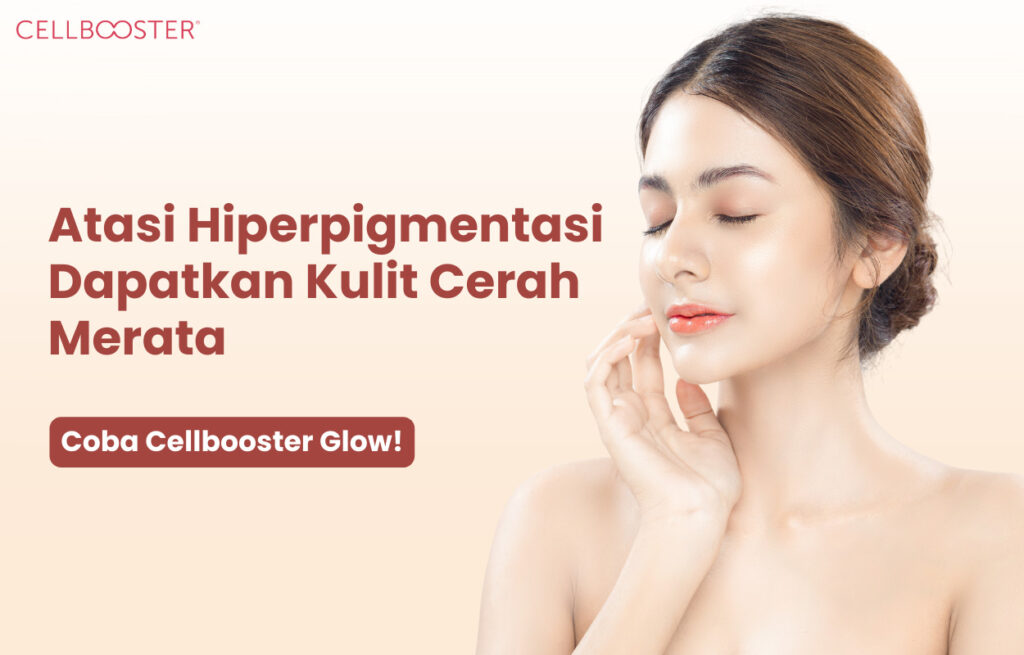 Hiperpigmentasi Adalah