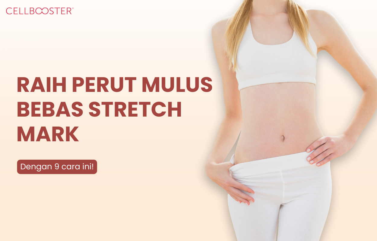 Stretch Mark di Perut