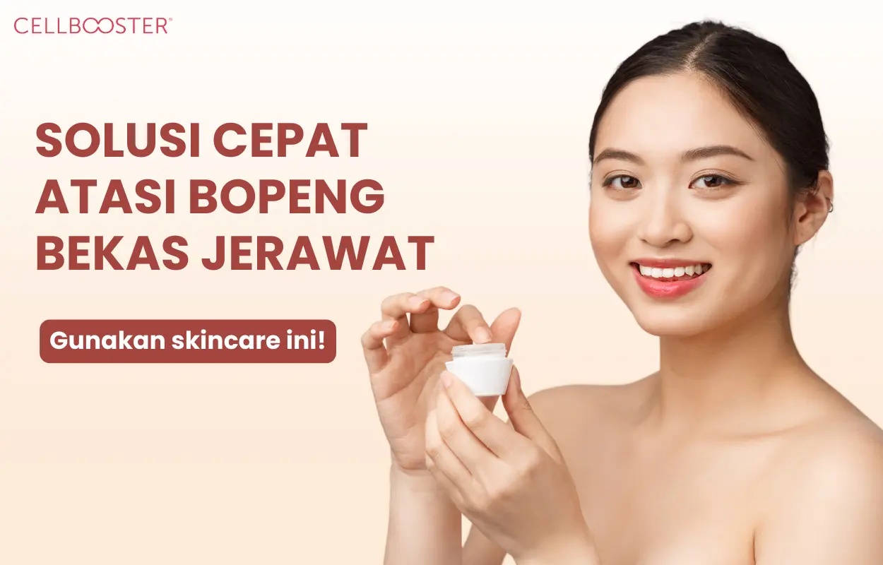 Skincare untuk Menghilangkan Bopeng